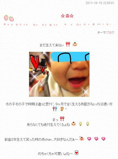 辻希美 歯A.jpg